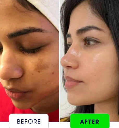 The Health Healer Night Cream | Celebrities favourite