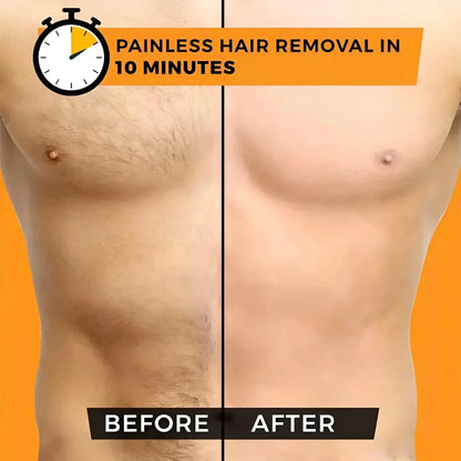 Sydonic Permanent Hair Removal Treatment | Facial & Body