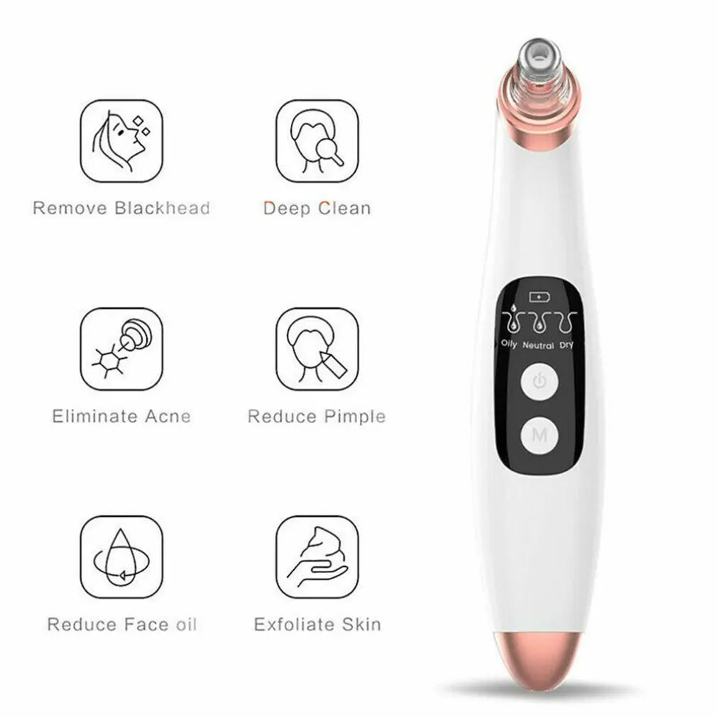 Electric Blackhead Remover