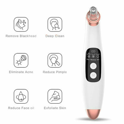 Electric Blackhead Remover