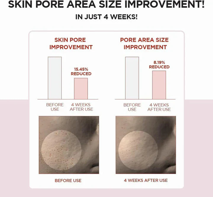 Skin 1004 Centella Poremizing clear Toner 210 ML