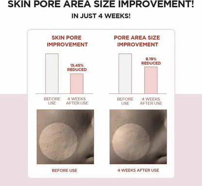 Skin 1004 Centella Poremizing clear Toner 210 ML