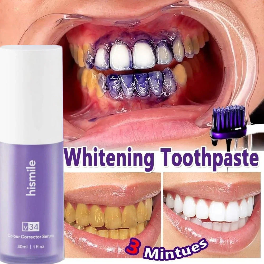 Hismile V34 Teeth Whitening Toothpaste